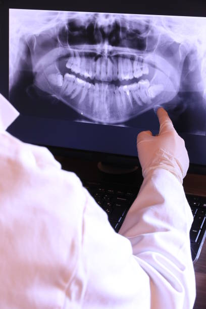 Best Emergency Wisdom Tooth Extraction in West Brattleboro, VT